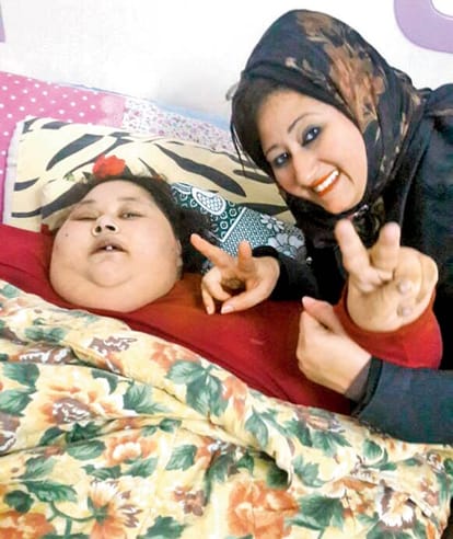 30 kg down in 5 days, world’s heaviest woman Eman Ahmed can now move limbs better
