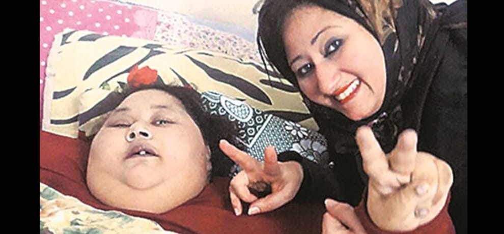 gurgaon doctors find that a gene is responsible for fatness of worlds heaviest woman eman ahmad