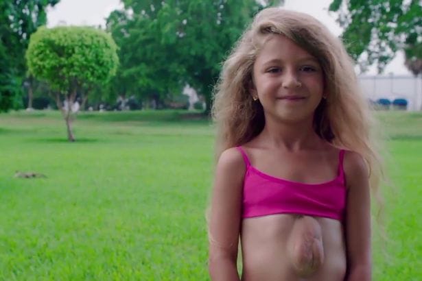 7-year-old girl born with her heart OUTSIDE her chest