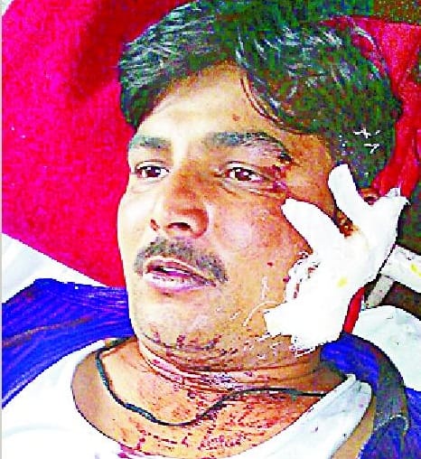 Couple robbed, shot