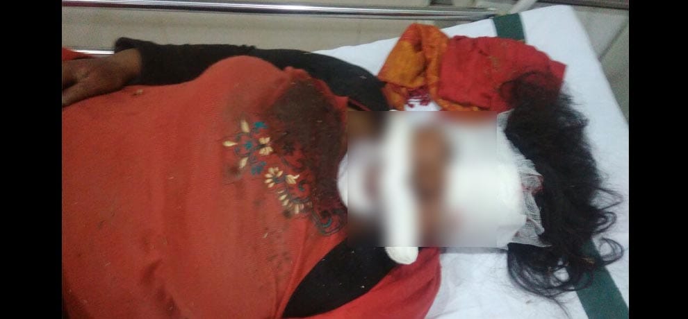 female teacher fall from auto after someone tried to abduct her in bareilly