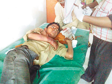 Teacher beating student arm broken