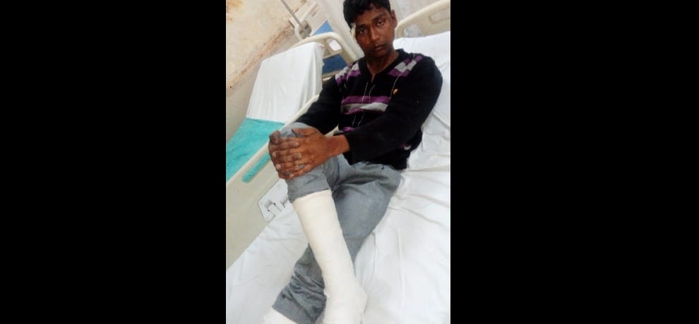 Had come to steal, making noises, then jumped out of fear, broken bones of legs