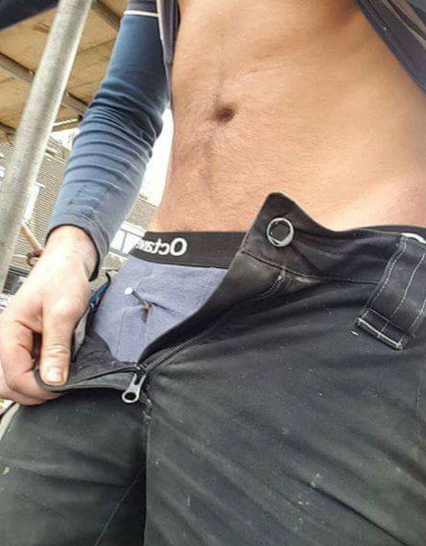 Builder accidentally fires nail gun into his own penis. 