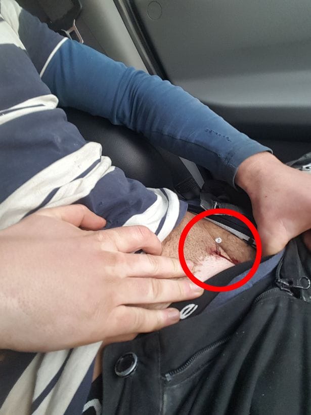 Builder accidentally fires nail gun into his own penis. 