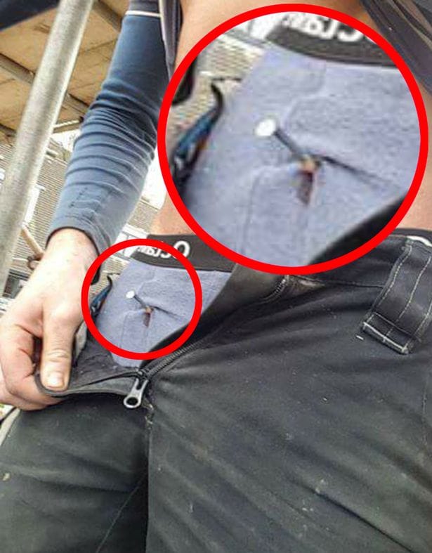 Builder accidentally fires nail gun into his own penis. 