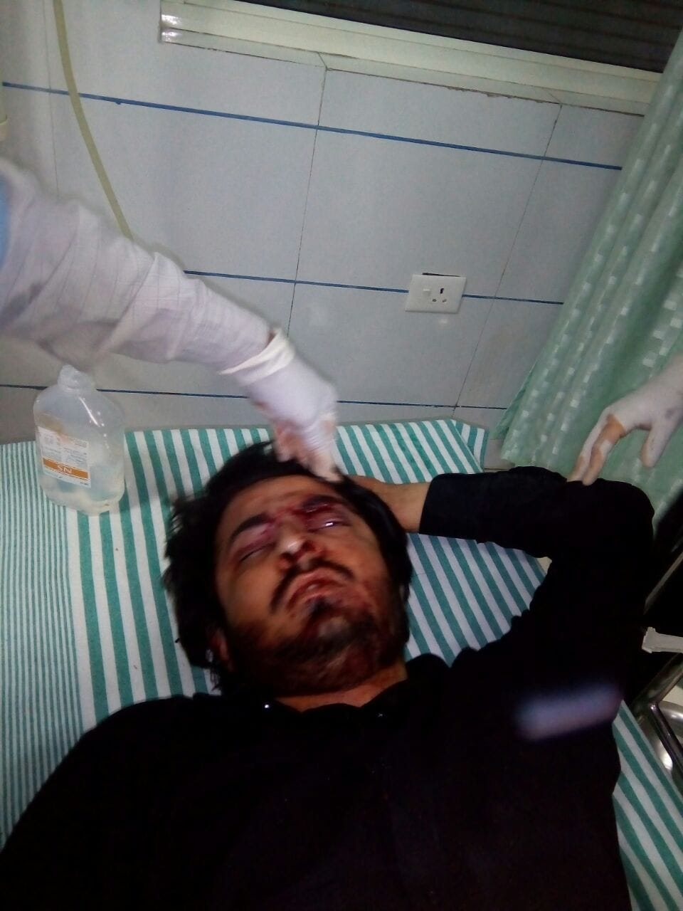 Painful accident on NH 58: You startling photos