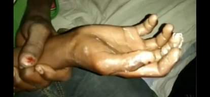 Hands of four children immersed in boiling oil for phone