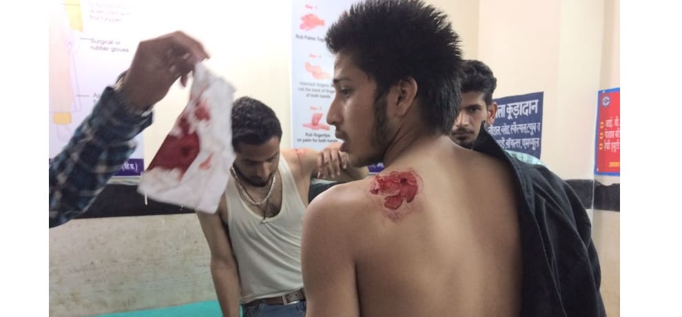 Clash between the ABVP and NSUI at Vallabh Govt Post Graduate College Mandi