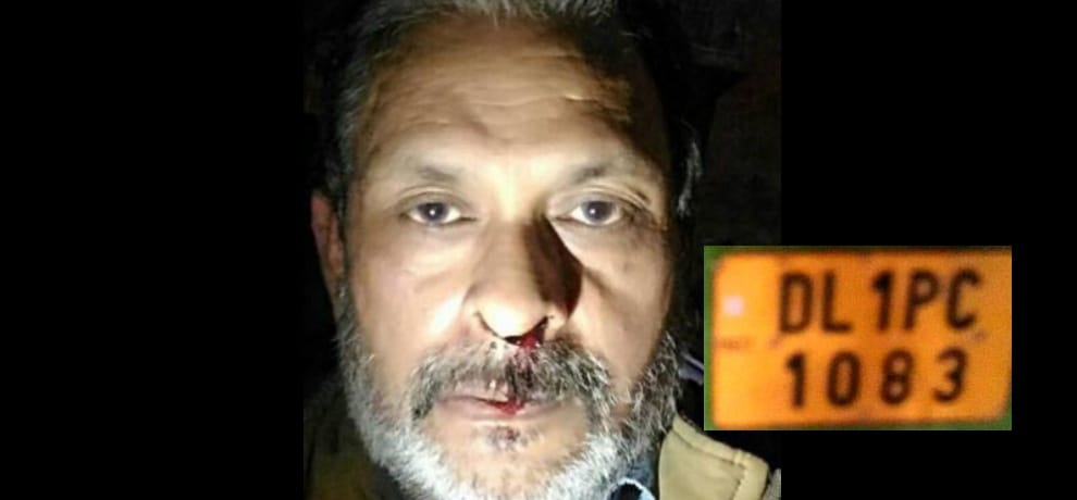 Disturbed by the roadside to urinate filmmaker Pete put the DTC bus conductor
