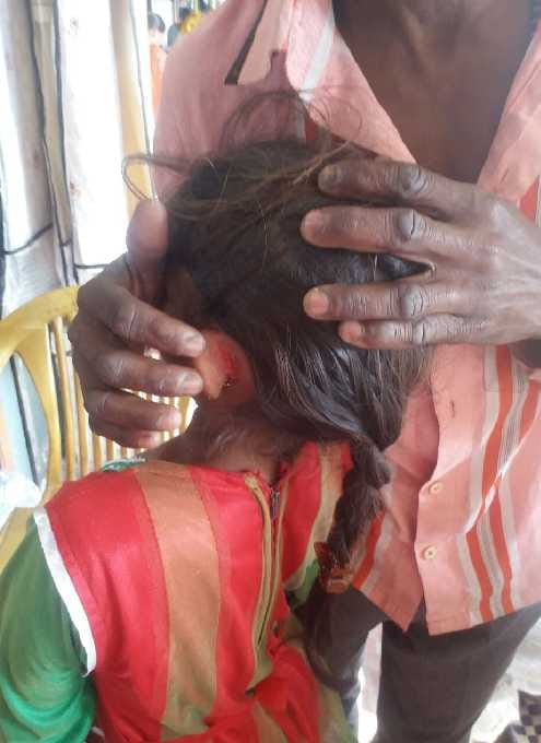 Teacher beating student torn ear