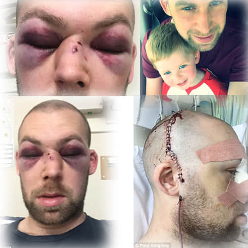  Yorkshire club cricketer Alex Tait suffered horrific facial injuries after being struck 