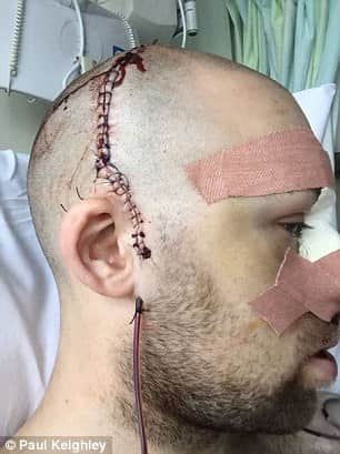 Yorkshire club cricketer Alex Tait suffered horrific facial injuries after being struck 