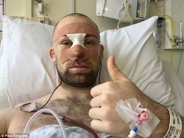  Yorkshire club cricketer Alex Tait suffered horrific facial injuries after being struck 
