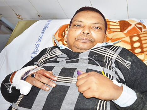 SBI manager Bilgram injured in a road accident