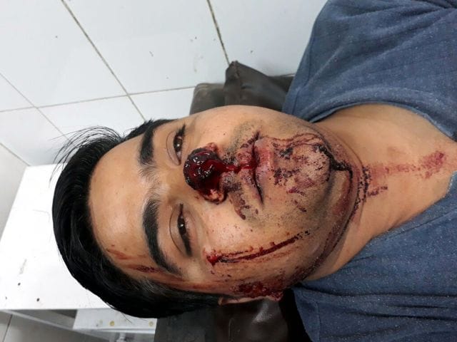Aligarh bypass attempted to rob Saraf