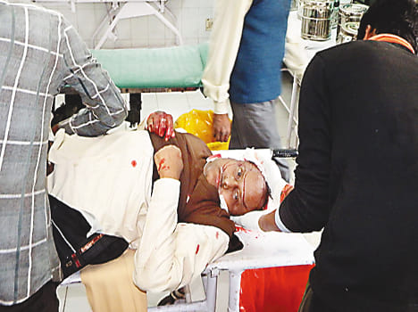 Three injured in two road accidents, including retired personnels