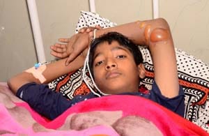 Student fees for broken hand
