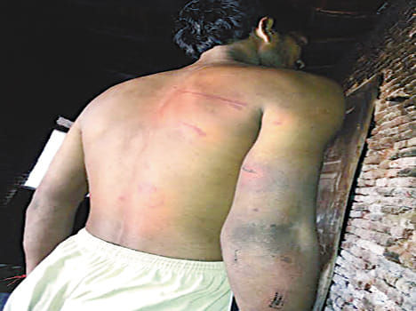Depressed young man brutally beaten in theft charges