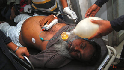 kanpur cardiology strike of doctors
