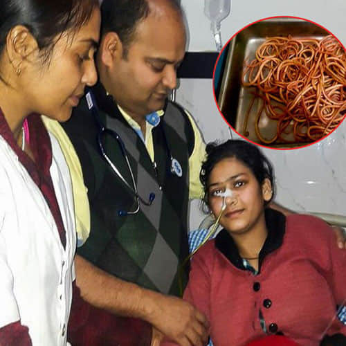 doctors found 150 earthworms in a woman stomach