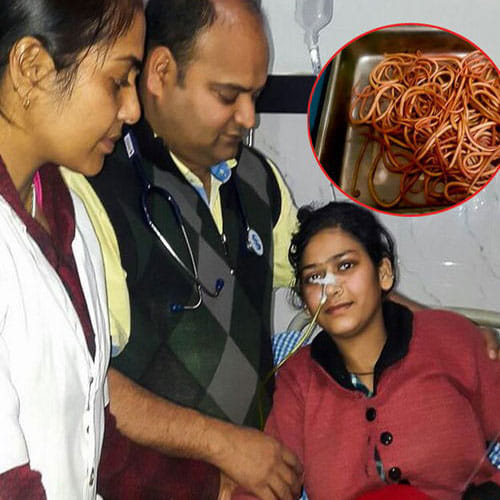doctors found 150 earthworms in a woman stomach