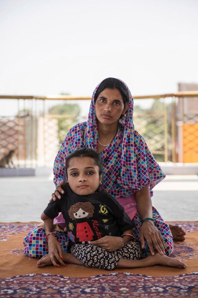 Teenager in India has broken her bones more than 1,000 TIMES due to rare condition