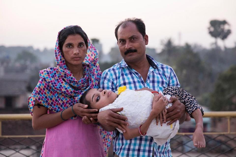 Teenager in India has broken her bones more than 1,000 TIMES due to rare condition