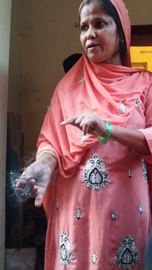 If marriage is not threatened to burn the face with acid