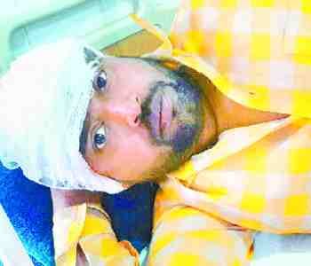 The attack on the wedding dispute in dance, five injured
