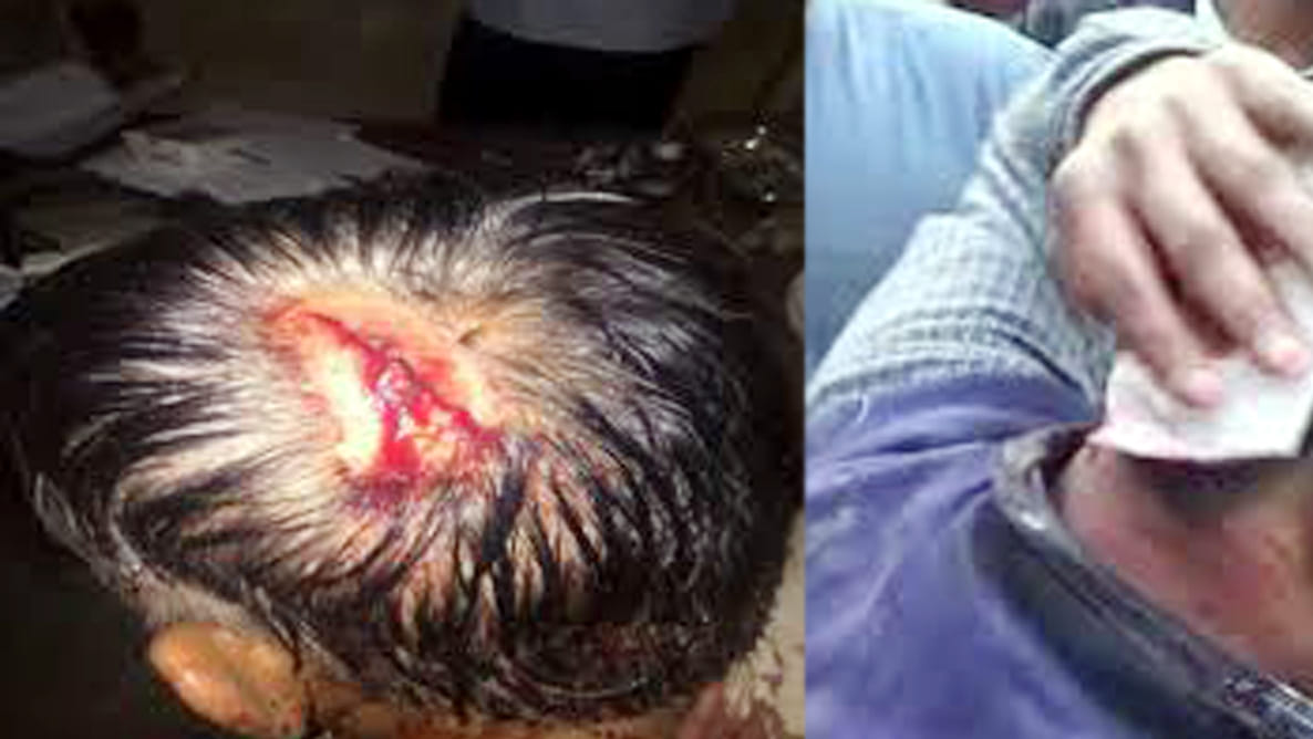 students attack on principal