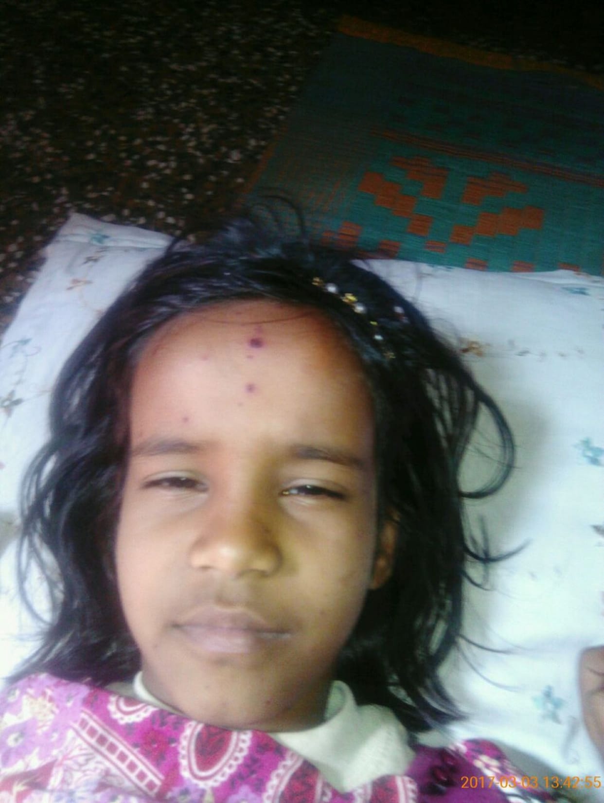 dakshin chhapattee mein phaila chikanapaaks, chhah bachche chapet mein