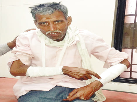 dispute broke her father's hand