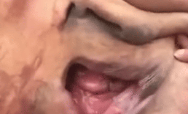 China's Elephant Man 39-year-old with a massive 33lb tumour growing from his face