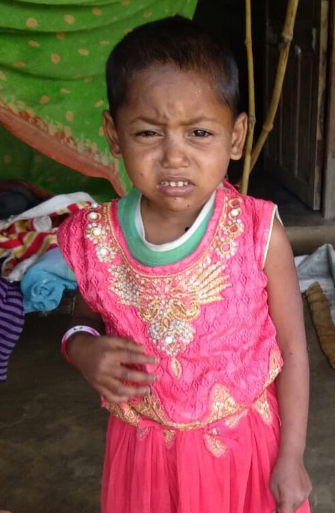 Many people suffering from measles