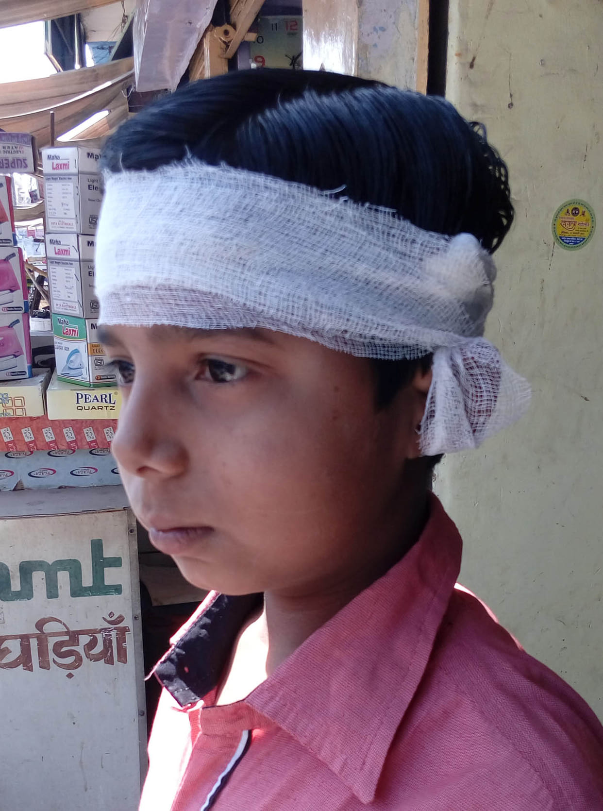 Four children injured in monkey attacks.