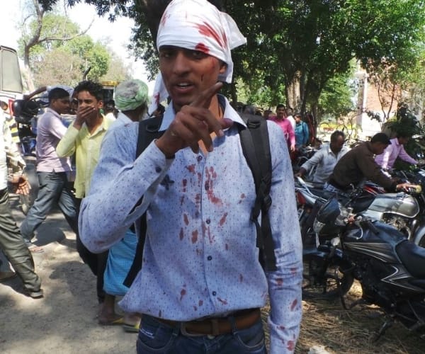  many injured in an accident in faizabad.