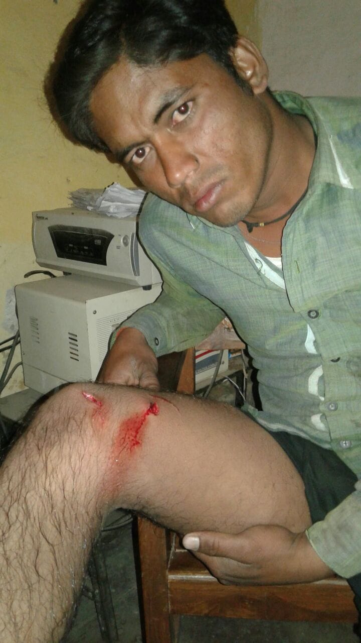 Tiger spoke again attacked, injured two farmers