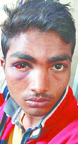 Sigh fire on youth in Adampur