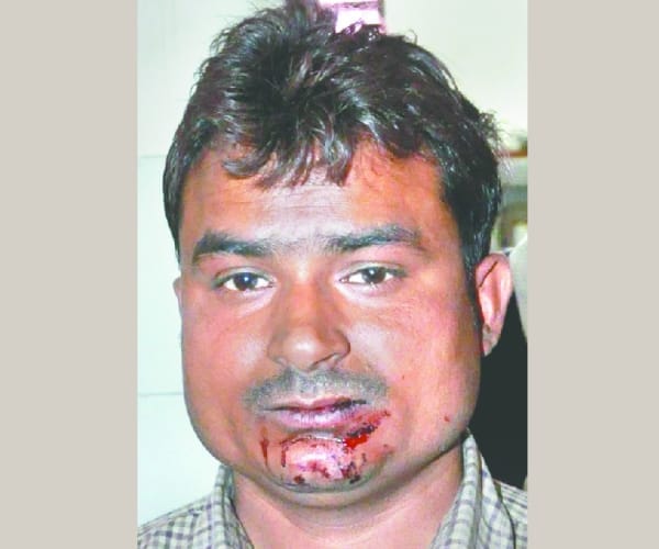  one died and many injured in an accident in barabanki.