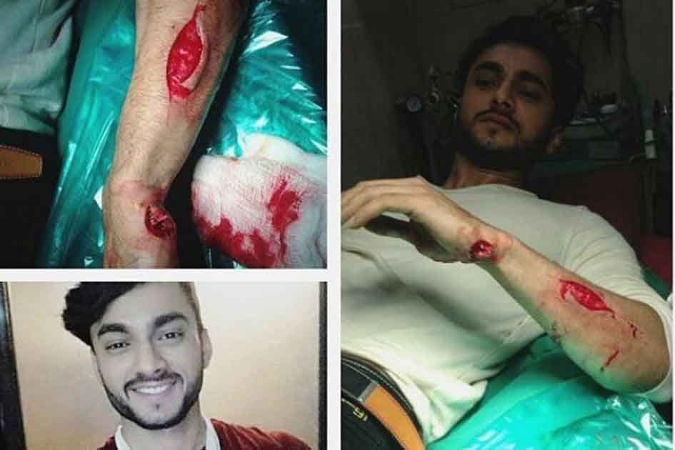 Actor aryan pandit injured during shoot of naagin 2