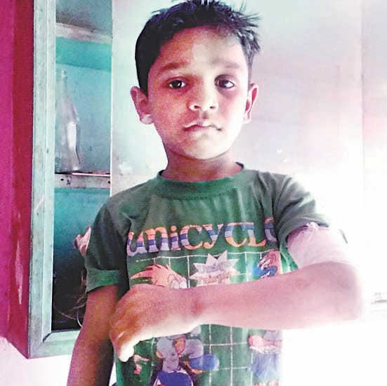 Two children injured  monkey attack
