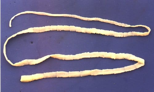 A 5-Foot Tapeworm Being Pulled Out Of A Man’s Nose 