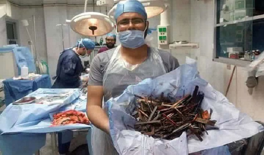 metals found in female stomach after operation