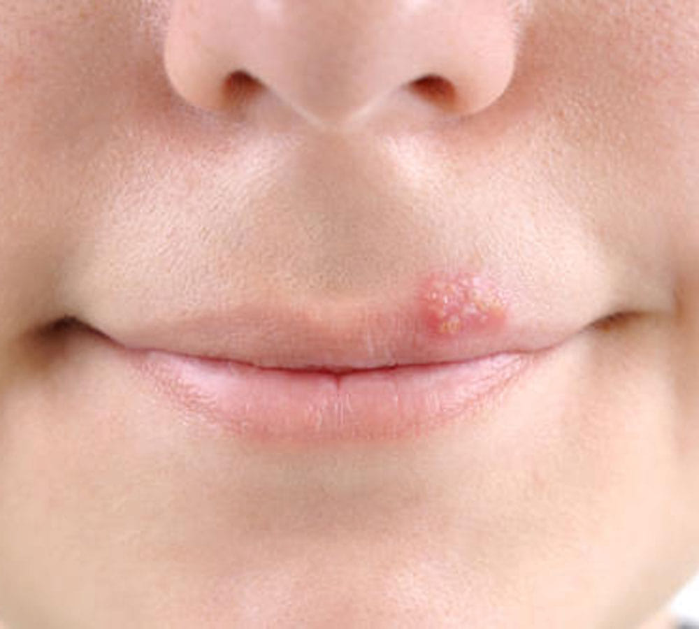 side effects of lip balm 