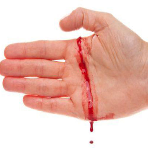 when human body parts openly fall from sky