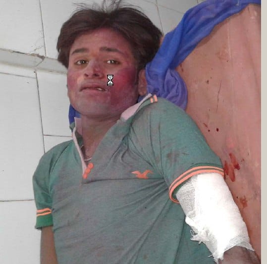 On the day of Holi, Sakudiya Jasarkanpur, on both sides, sticks and sticks