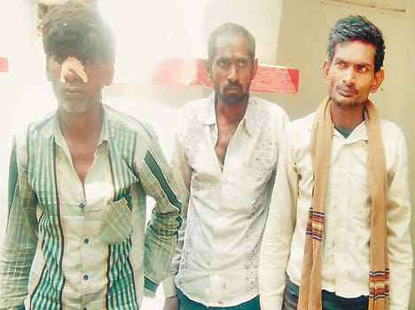 Strike with stones at UP 100 approaching to apprehend the accused