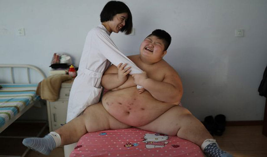 fire in body for loosing excessive weight
