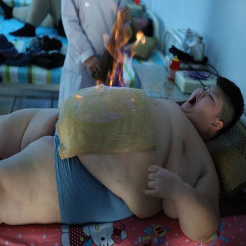 fire in body for loosing excessive weight
